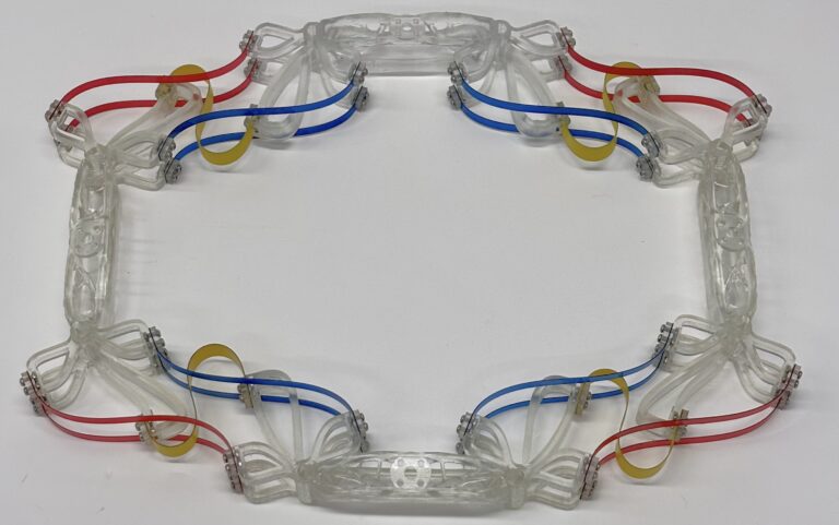 BuckledElasticStrips